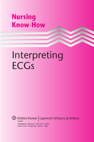 Nursing Know-How: Interpreting ECGs