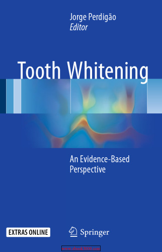 Tooth Whitening: An Evidence-Based Perspective