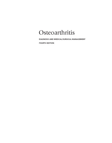 Osteoarthritis: Diagnosis and Medical/Surgical Management