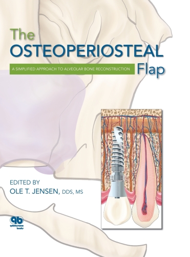 The Osteoperiosteal Flap: A Simplified Approach to Alveolar Bone Reconstruction