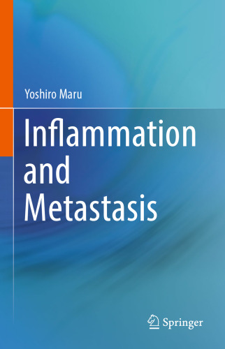 Inflammation and Metastasis