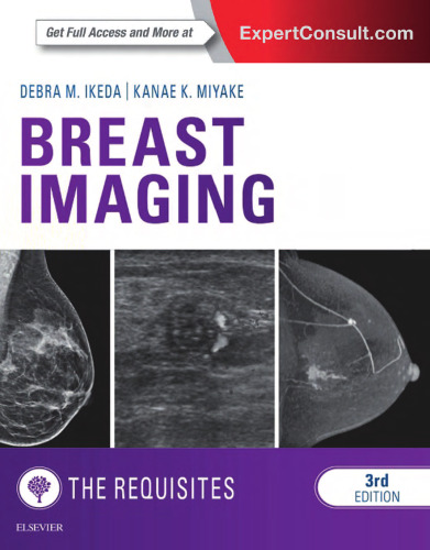 Breast Imaging: The Requisites