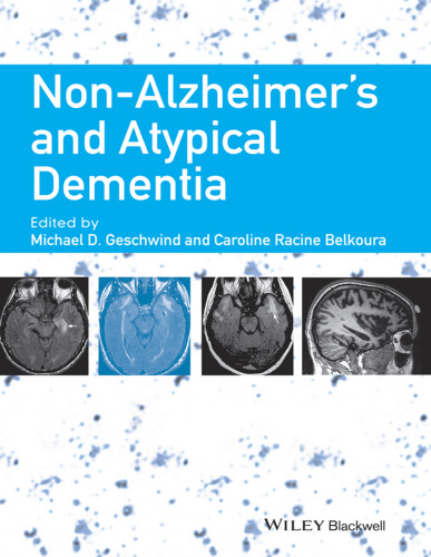 Non-Alzheimer's and atypical dementia