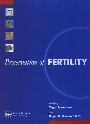 Preservation of fertility