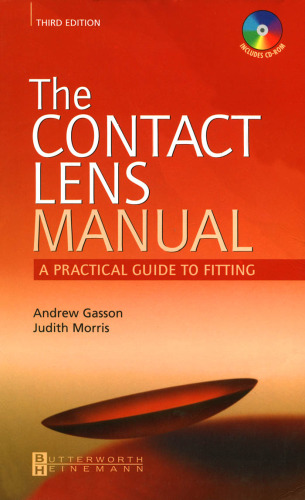 The Contact Lens Manual: A Practical Guide to Fitting