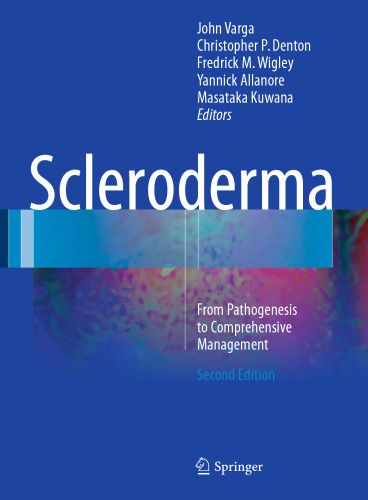 Scleroderma: From Pathogenesis to Comprehensive Management