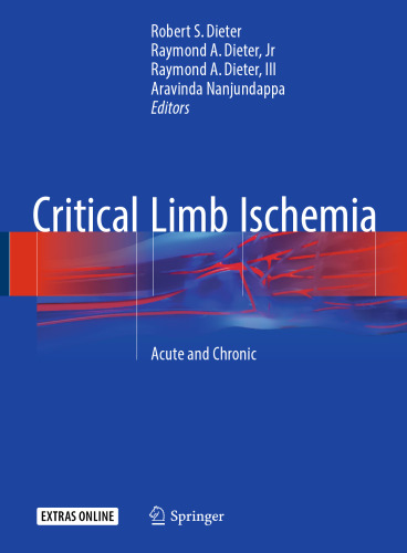 Critical Limb Ischemia: Acute and Chronic