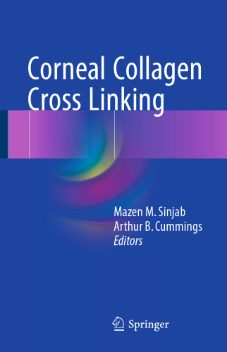 Corneal Collagen Cross Linking