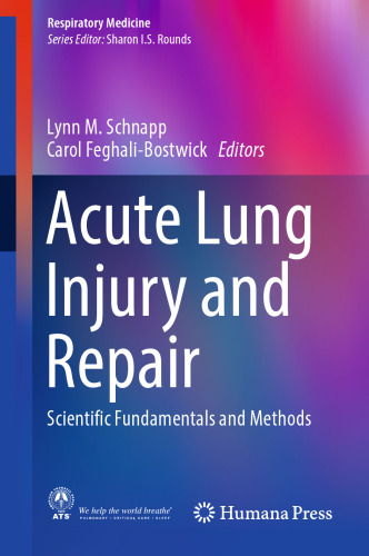 Acute Lung Injury and Repair: Scientific Fundamentals and Methods