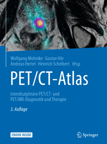 PET/CT-Atlas: Interdisziplinäre PET/CT- und PET/MR-Diagnostik und Therapie