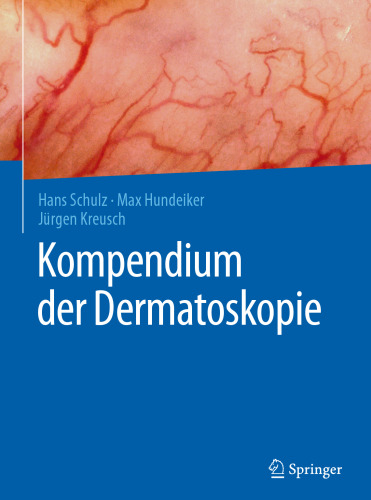 Kompendium der Dermatoskopie