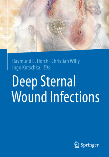 Deep Sternal Wound Infections