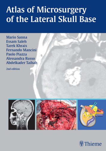 Atlas of microsurgery of the lateral skull base