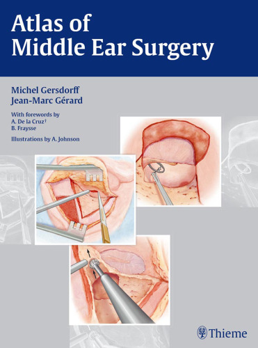 Atlas of middle ear surgery