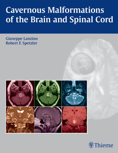 Cavernous malformations of the brain and spinal cord