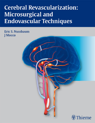 Cerebral revascularization: microsurgical and endovascular techniques