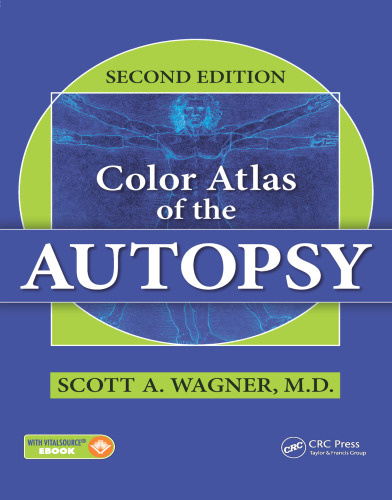 Color Atlas of the Autopsy Contains Access to Vitalsource Ebook Version