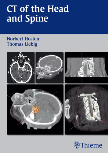 CT of the head and spine