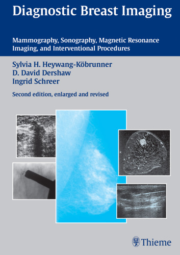 Diagnostic breast imaging: mammography, sonography, magnetic resonance imaging, and interventional procedures