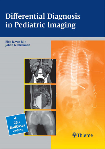 Differential diagnosis in pediatric imaging