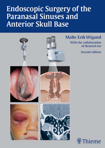 Endoscopic surgery of the paranasal sinuses and anterior skull base