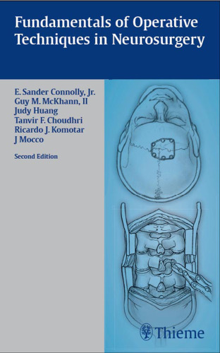 Fundamentals of operative techniques in neurosurgery