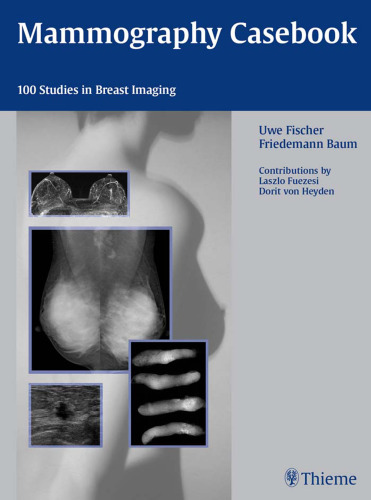 Mammography casebook: 100 studies in breast imaging ; 168 tables