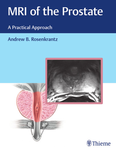 MRI of the prostate: a practical approach