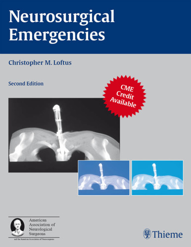 Neurosurgical emergencies