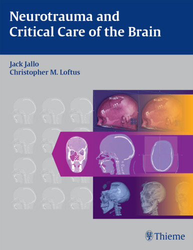 Neurotrauma and critical care of the brain