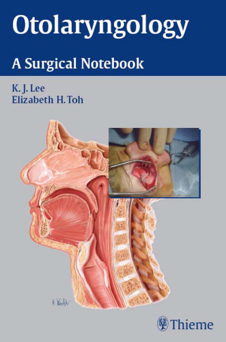 Otolaryngology: a surgical notebook