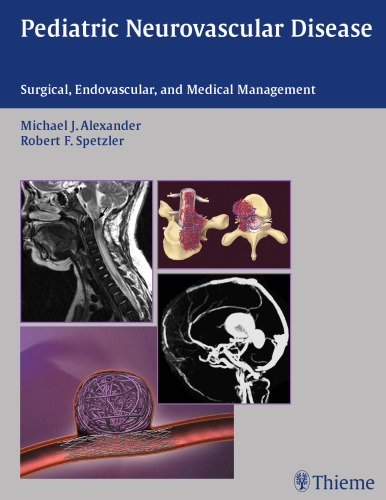 Pediatric neurovascular disease: surgical, endovascular, and medical management