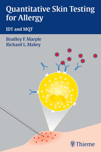 Quantitative skin testing for allergy: IDT and MQT