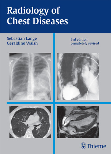 Radiology of chest diseases