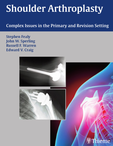 Shoulder arthroplasty: complex issues in the primary and revision setting