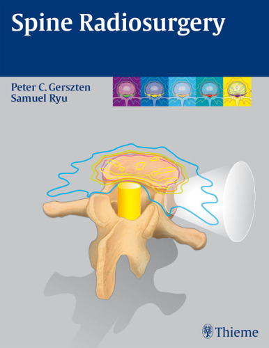 Spine radiosurgery