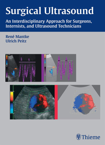 Surgical Ultrasound: An Interdisciplinary Approach for Surgeons, Internists, and Ultrasound Technicians