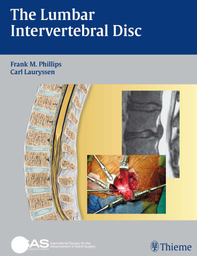 The lumbar intervertebral disc