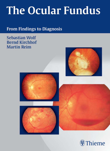 The ocular fundus: from findings to diagnosis