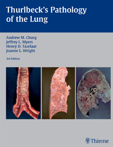 Thurlbeck’s pathology of the lung