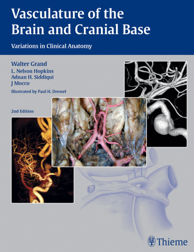 Vasculature of the brain and cranial base: variations in clinical anatomy