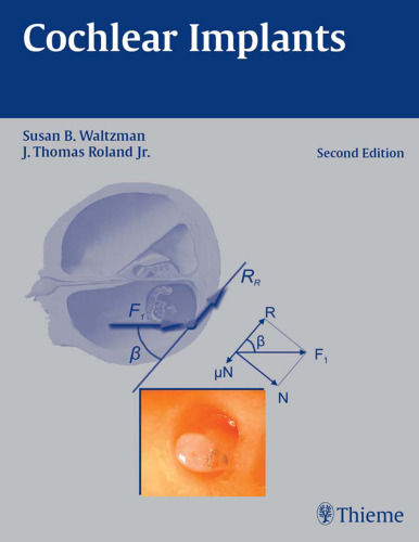 Cochlear Implants