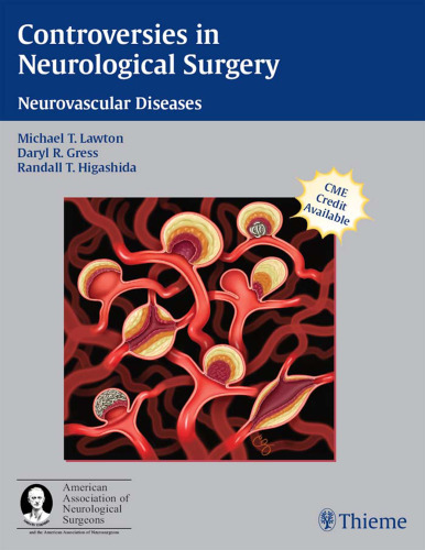 Controversies in Neurological Surgery: Neurovascular Diseases