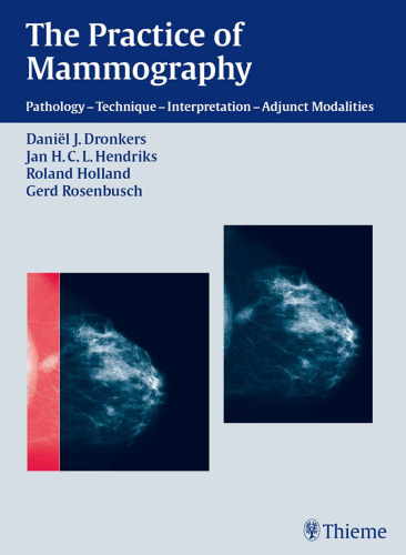 The Practice of Mammography: Pathology - Technique - Interpretation - Adjunct Modalities