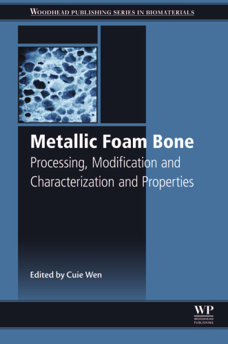 Metallic Foam Bone: Processing, Modification and Characterization and Properties