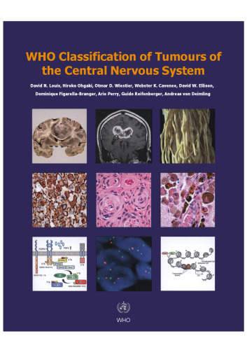 WHO Classification of Tumours of the Central Nervous System