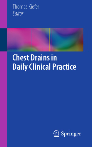Chest Drains in Daily Clinical Practice 