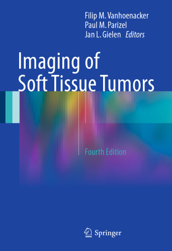 Imaging of Soft Tissue Tumors