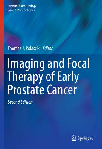 Imaging and Focal Therapy of Early Prostate Cancer