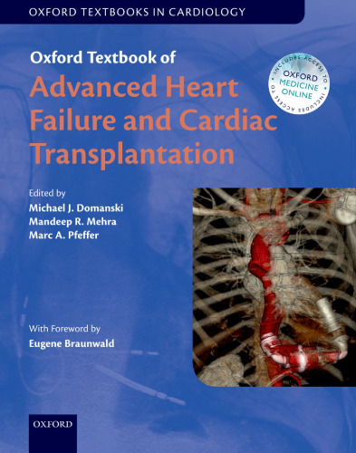 Oxford textbook of advanced heart failure and cardiac transplantation